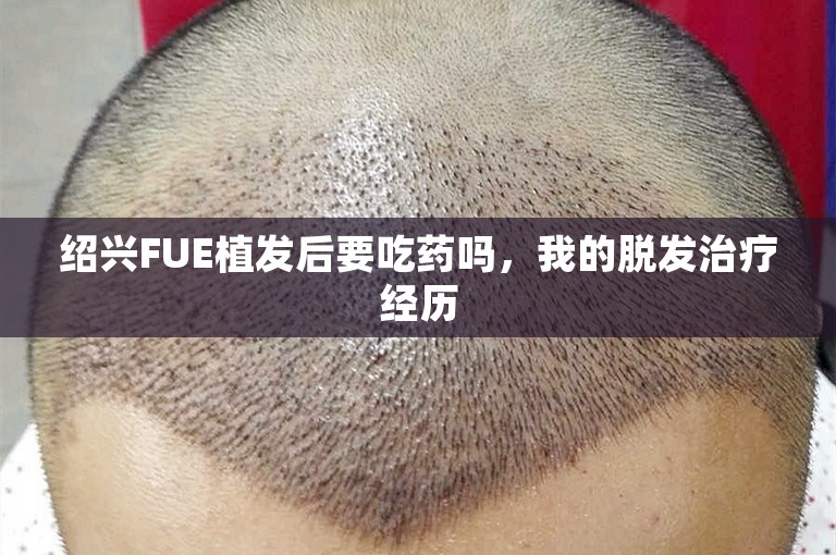 绍兴FUE植发后要吃药吗，我的脱发治疗经历