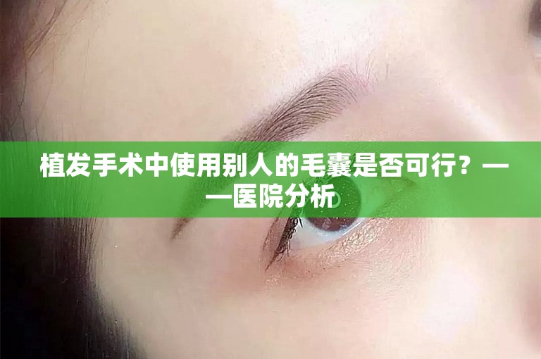  植发手术中使用别人的毛囊是否可行？——医院分析