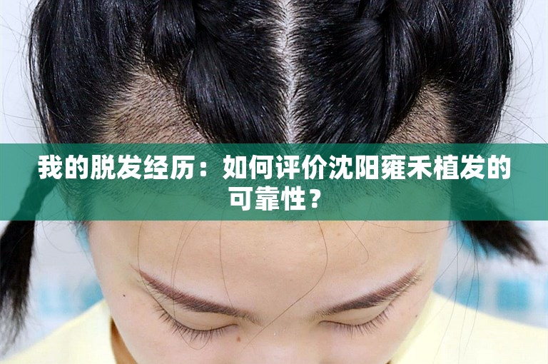 我的脱发经历：如何评价沈阳雍禾植发的可靠性？