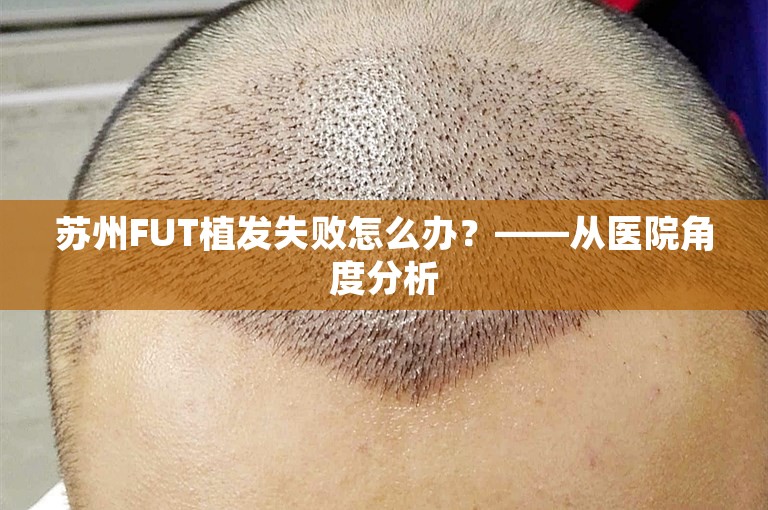 苏州FUT植发失败怎么办？——从医院角度分析