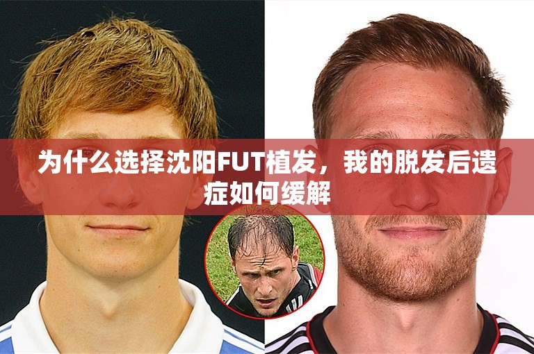 为什么选择沈阳FUT植发，我的脱发后遗症如何缓解