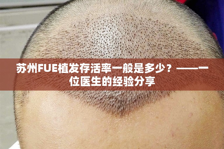 苏州FUE植发存活率一般是多少？——一位医生的经验分享