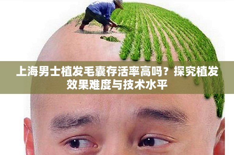 上海男士植发毛囊存活率高吗？探究植发效果难度与技术水平