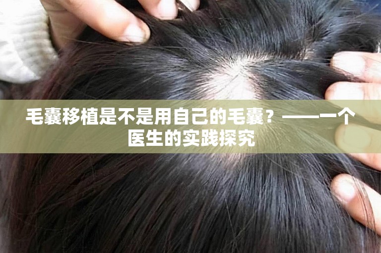 毛囊移植是不是用自己的毛囊？——一个医生的实践探究