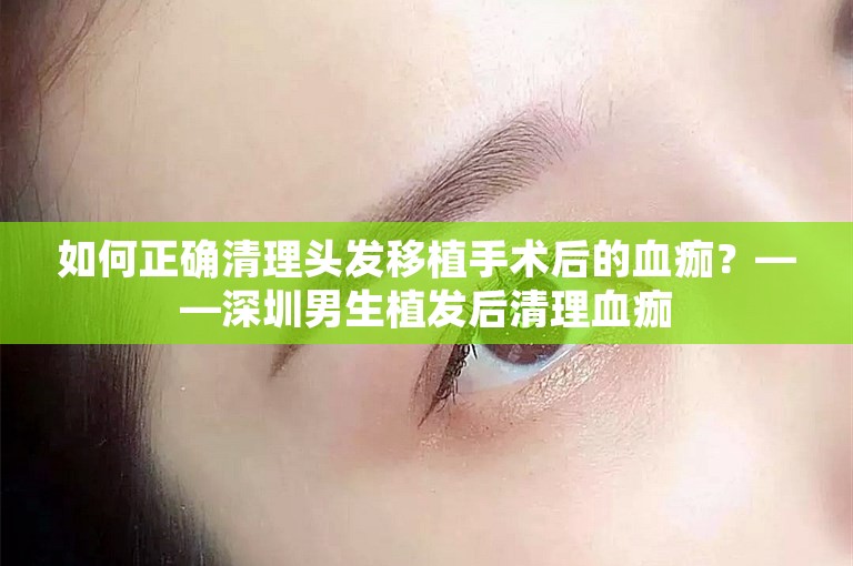 如何正确清理头发移植手术后的血痂？——深圳男生植发后清理血痂