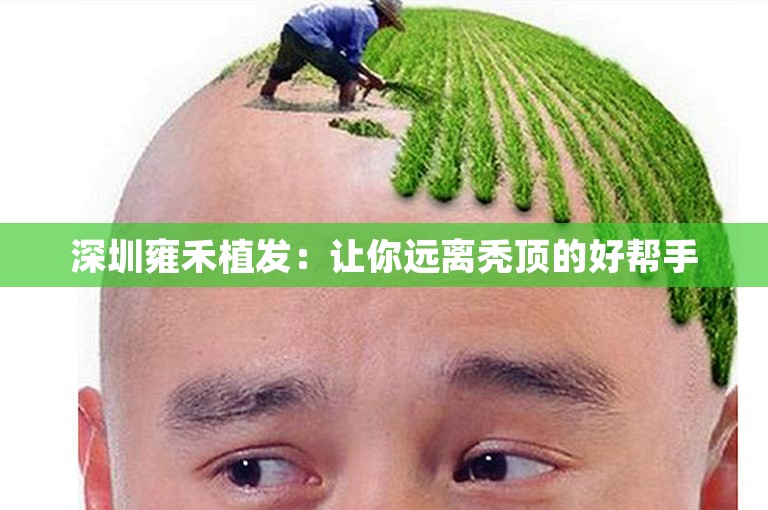 深圳雍禾植发：让你远离秃顶的好帮手