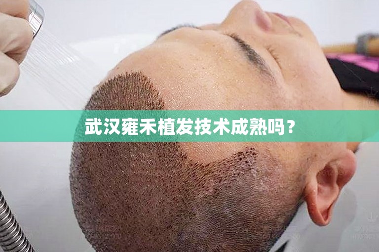 武汉雍禾植发技术成熟吗？