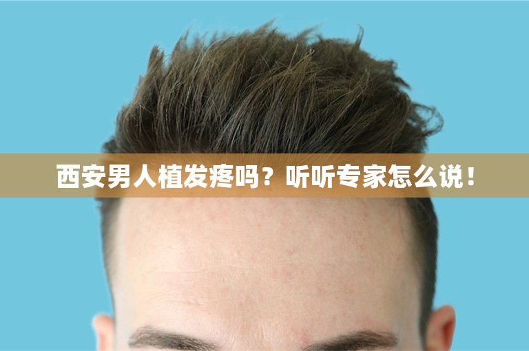 西安男人植发疼吗？听听专家怎么说！