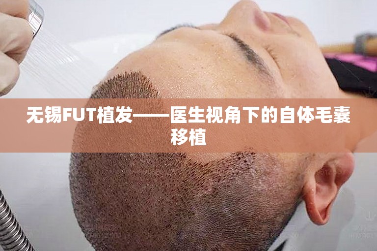 无锡FUT植发——医生视角下的自体毛囊移植