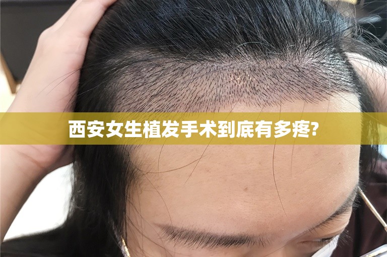 西安女生植发手术到底有多疼?