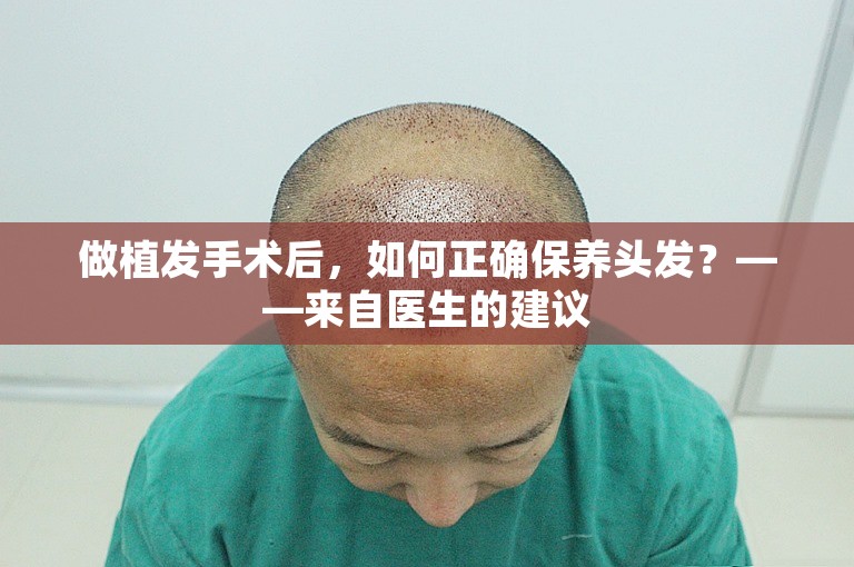 做植发手术后，如何正确保养头发？——来自医生的建议