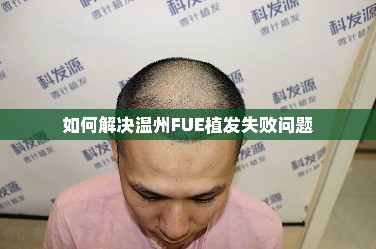 如何解决温州FUE植发失败问题