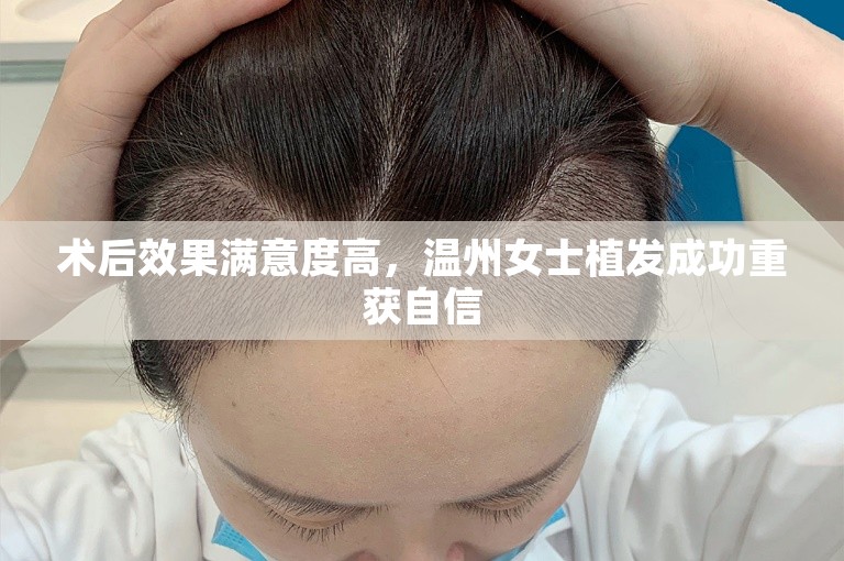 术后效果满意度高，温州女士植发成功重获自信