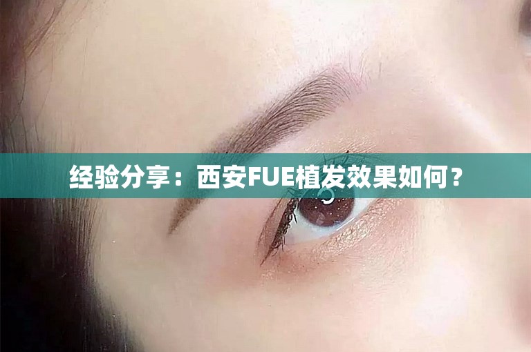 经验分享：西安FUE植发效果如何？