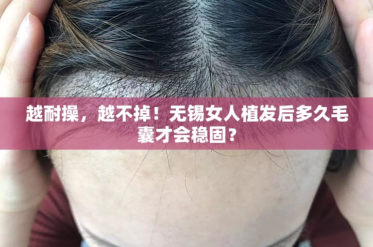 越耐操，越不掉！无锡女人植发后多久毛囊才会稳固？