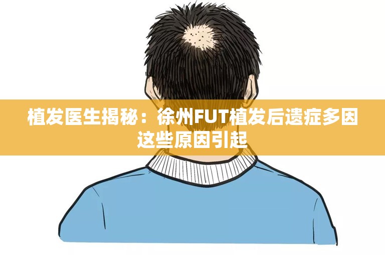 植发医生揭秘：徐州FUT植发后遗症多因这些原因引起