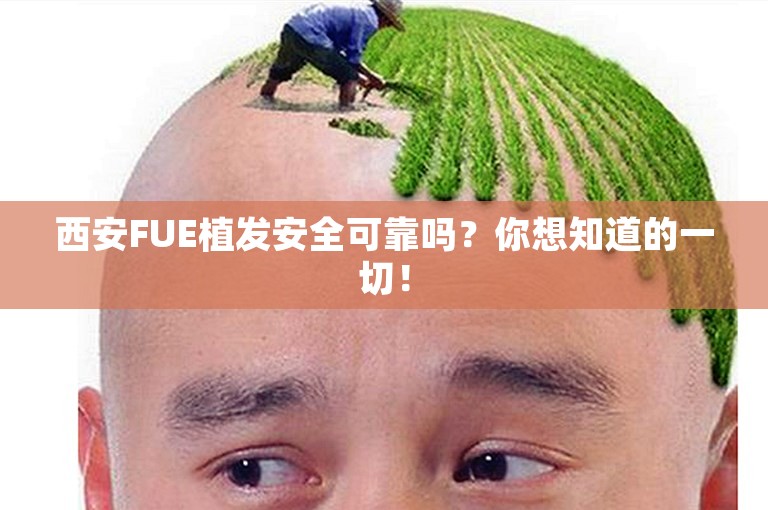 西安FUE植发安全可靠吗？你想知道的一切！