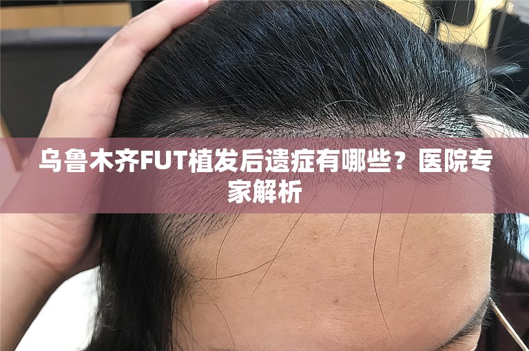 乌鲁木齐FUT植发后遗症有哪些？医院专家解析