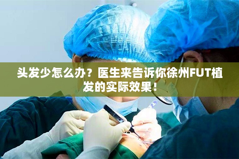 头发少怎么办？医生来告诉你徐州FUT植发的实际效果！