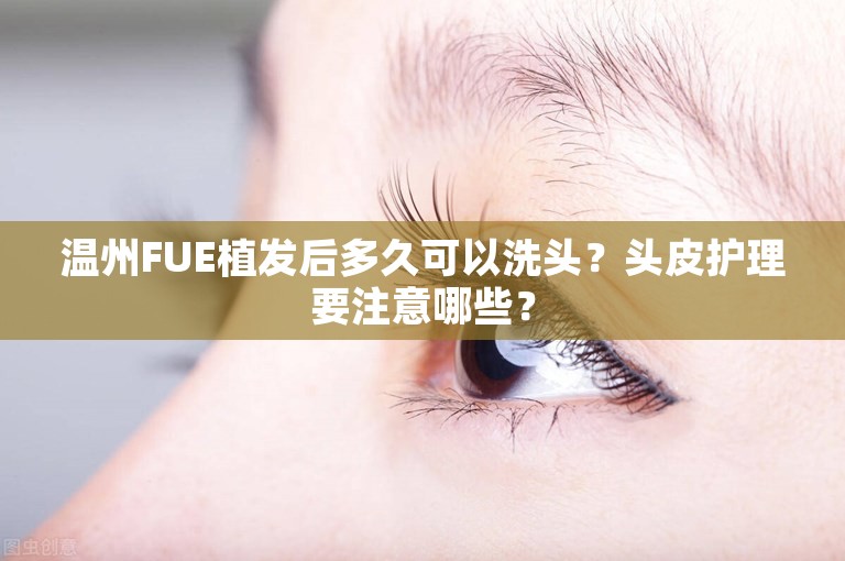 温州FUE植发后多久可以洗头？头皮护理要注意哪些？