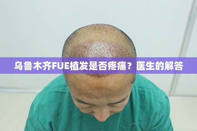 乌鲁木齐FUE植发是否疼痛？医生的解答