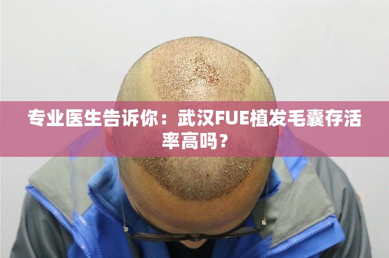 专业医生告诉你：武汉FUE植发毛囊存活率高吗？