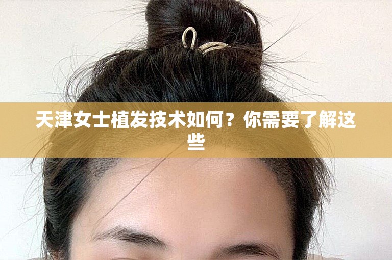 天津女士植发技术如何？你需要了解这些