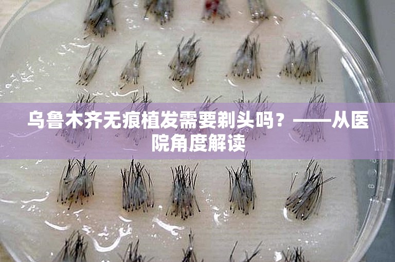 乌鲁木齐无痕植发需要剃头吗？——从医院角度解读