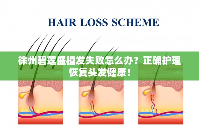 徐州碧莲盛植发失败怎么办？正确护理恢复头发健康！