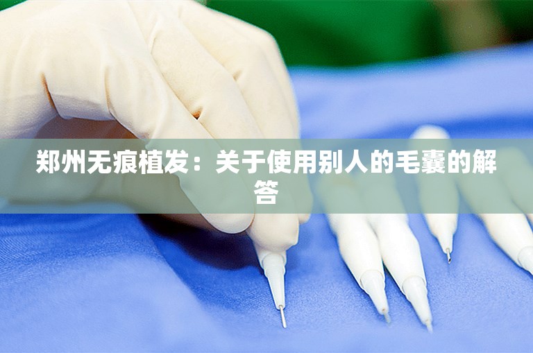 郑州无痕植发：关于使用别人的毛囊的解答