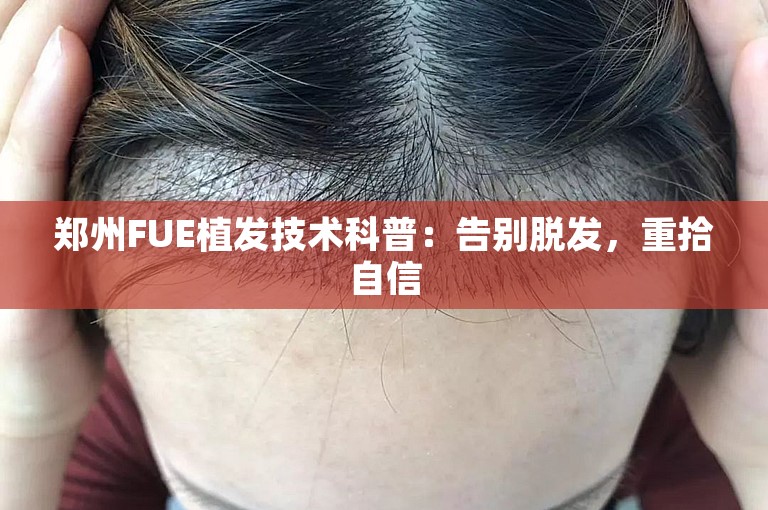 郑州FUE植发技术科普：告别脱发，重拾自信