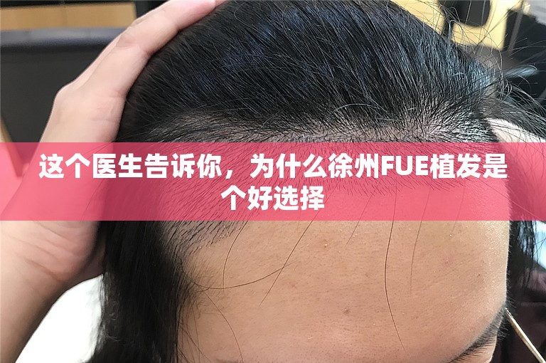 这个医生告诉你，为什么徐州FUE植发是个好选择