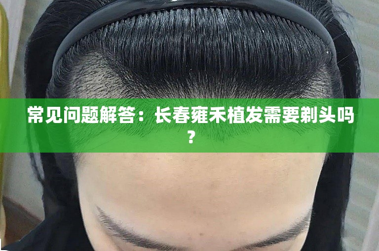 常见问题解答：长春雍禾植发需要剃头吗？