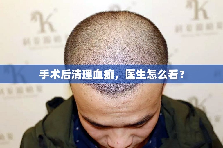 手术后清理血痂，医生怎么看？