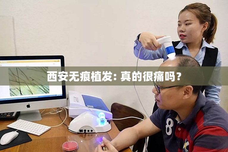 西安无痕植发: 真的很痛吗？