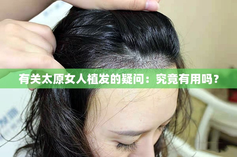 有关太原女人植发的疑问：究竟有用吗？