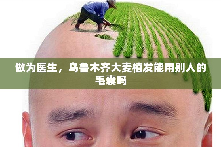 做为医生，乌鲁木齐大麦植发能用别人的毛囊吗