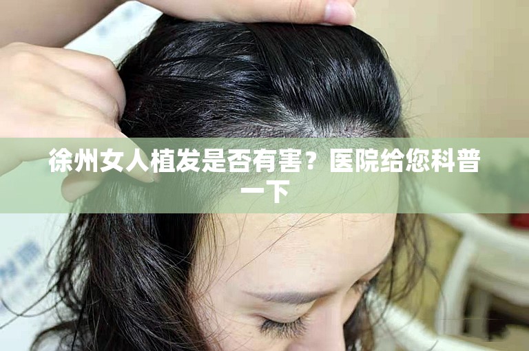 徐州女人植发是否有害？医院给您科普一下