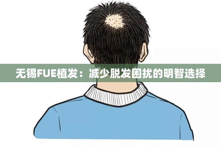 无锡FUE植发：减少脱发困扰的明智选择