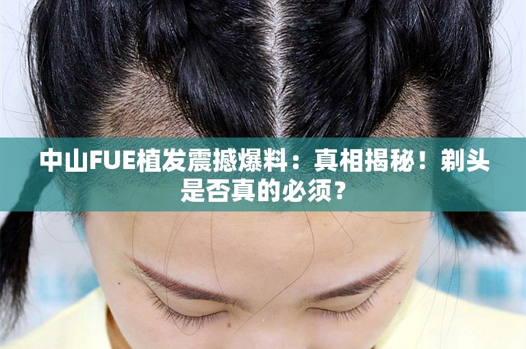 中山FUE植发震撼爆料：真相揭秘！剃头是否真的必须？