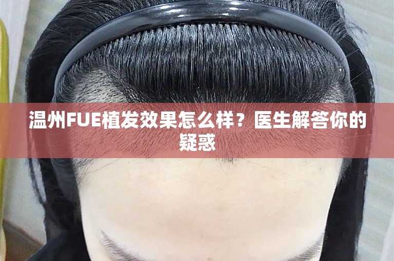 温州FUE植发效果怎么样？医生解答你的疑惑