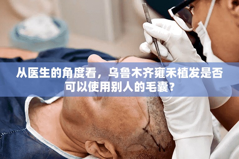 从医生的角度看，乌鲁木齐雍禾植发是否可以使用别人的毛囊？