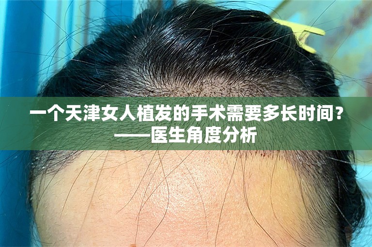 一个天津女人植发的手术需要多长时间？——医生角度分析