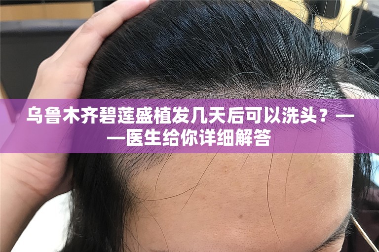 乌鲁木齐碧莲盛植发几天后可以洗头？——医生给你详细解答