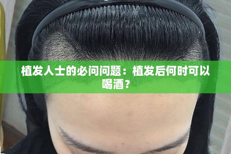 植发人士的必问问题：植发后何时可以喝酒？