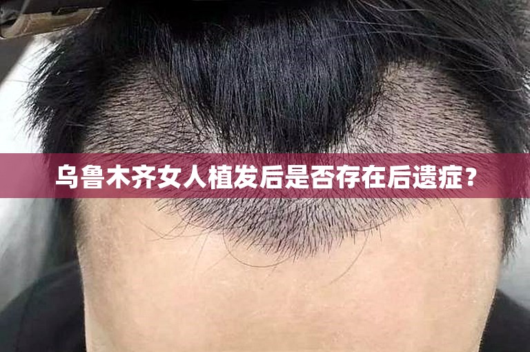 乌鲁木齐女人植发后是否存在后遗症？