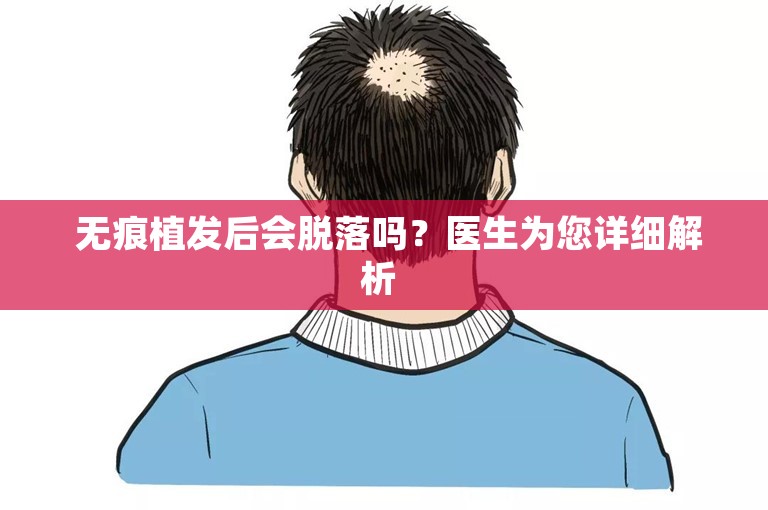  无痕植发后会脱落吗？医生为您详细解析 