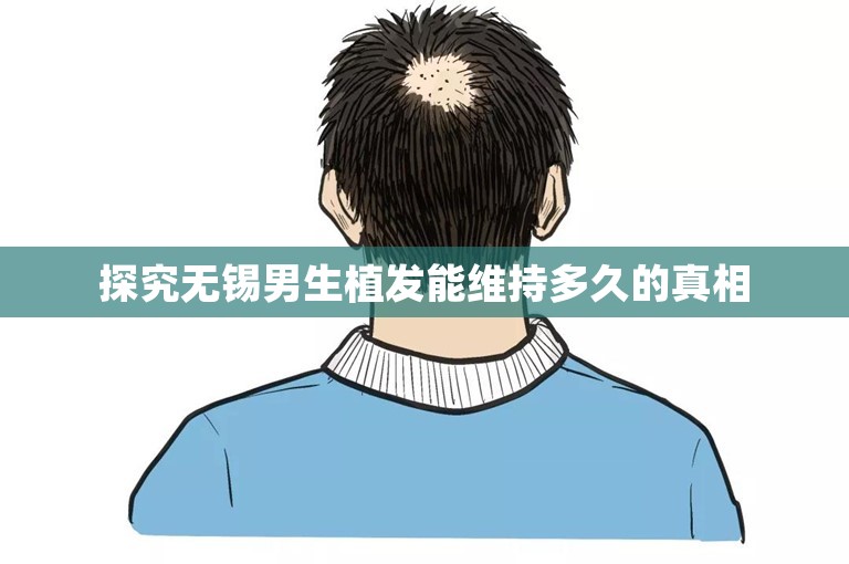 探究无锡男生植发能维持多久的真相