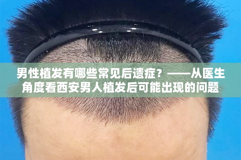 男性植发有哪些常见后遗症？——从医生角度看西安男人植发后可能出现的问题