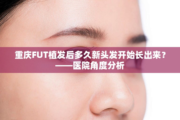 重庆FUT植发后多久新头发开始长出来？——医院角度分析